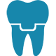 Prótesis dental